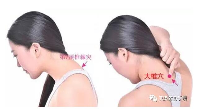 大椎穴.jpg