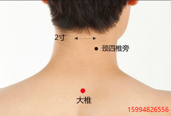 5.18大椎穴.png